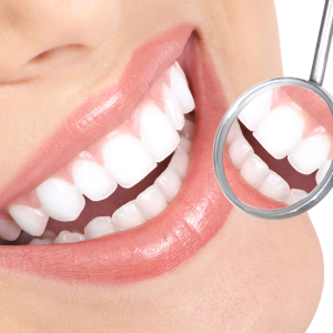 Diseño de Sonrisa 16 carillas