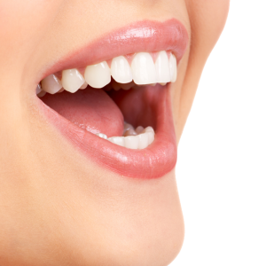 Diseño de sonrisa 8 carillas